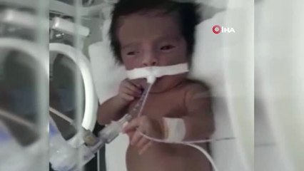 Hastalığı Teşhis Edilemeyen 5 Aylık Eymen'in Annesi, Ağlama Sesine Hasret