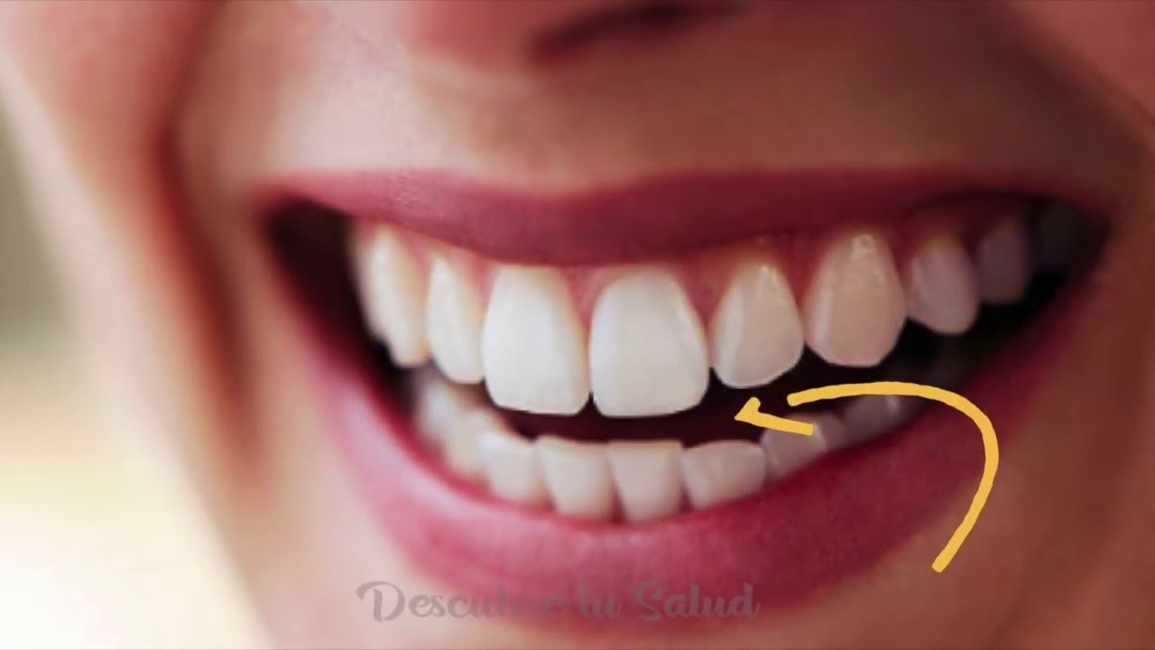 Dile adios al Sarro, Gingivitis y Mal Aliento con este Aceite Comestible