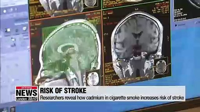 Korean researchers reveal how cigarette smoke, cadmium exposure increase risk of stroke