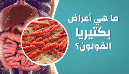 ما هي أعراض بكتيريا القولون؟