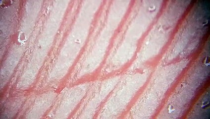 Seat and Oil Leaking from Finger