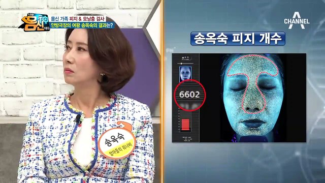 몸신 마님 '송옥숙' 피지 여왕으로 등극?! (feat. 모낭충 피지 먹방.avi)