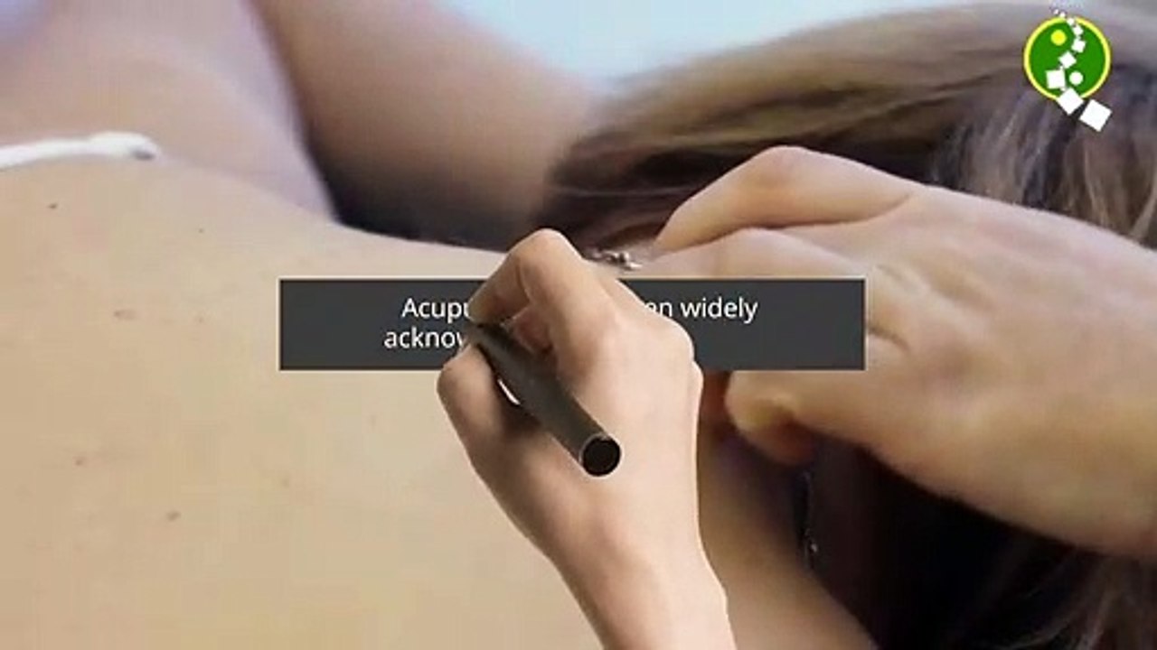 Acupuncture Therapy Treatment - Best Option for Pain Reliever