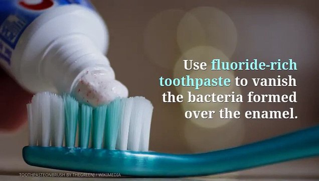 Home Remedies to treat tooth decay