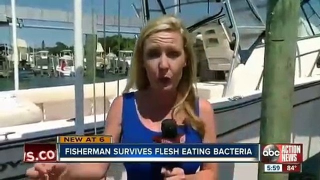 Florida Man Almost Loses Hand To Rare Flesh-Eating Bacteria