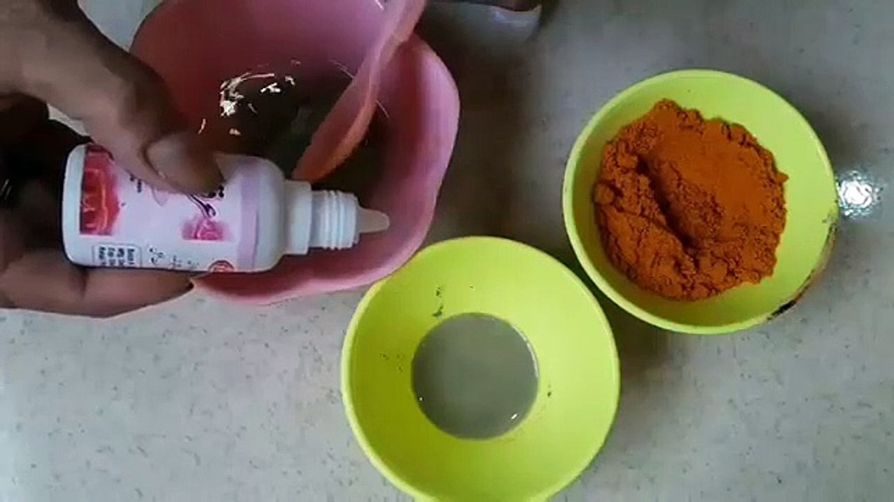 How to get rid of acne in just 10 days amazing remedy for acne remove acne