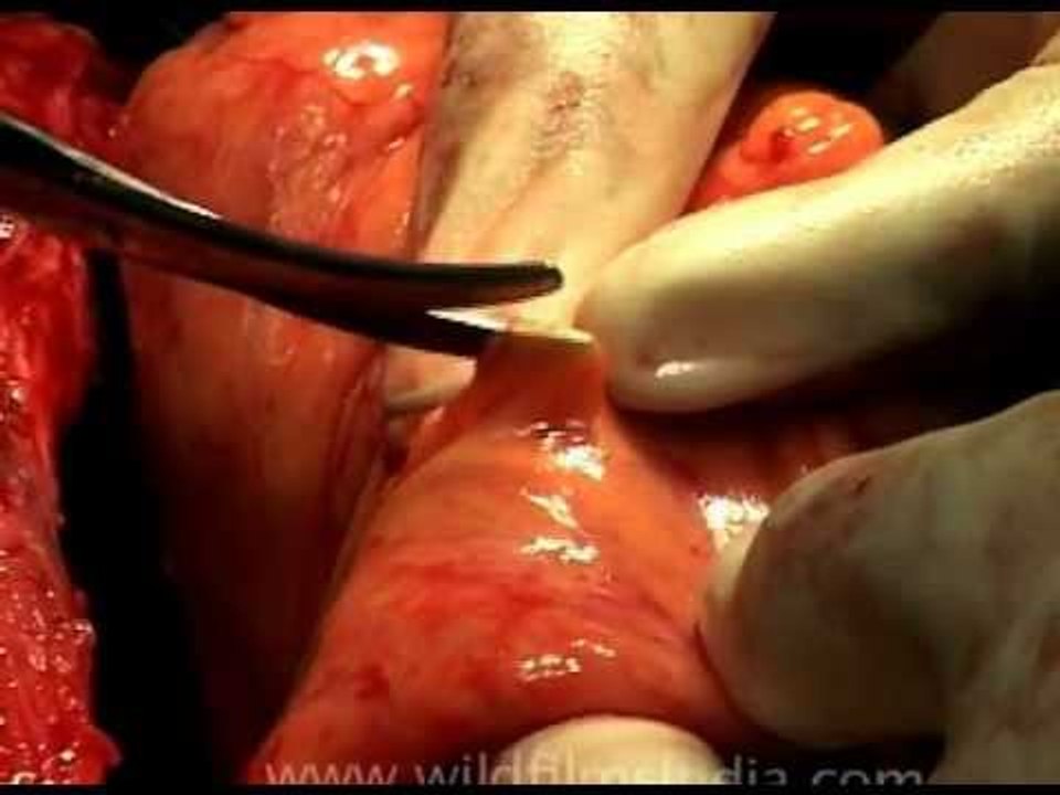 Amazing surgery