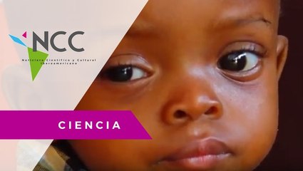 Alerta UNICEF sobre sarampión como amenaza creciente en la infancia