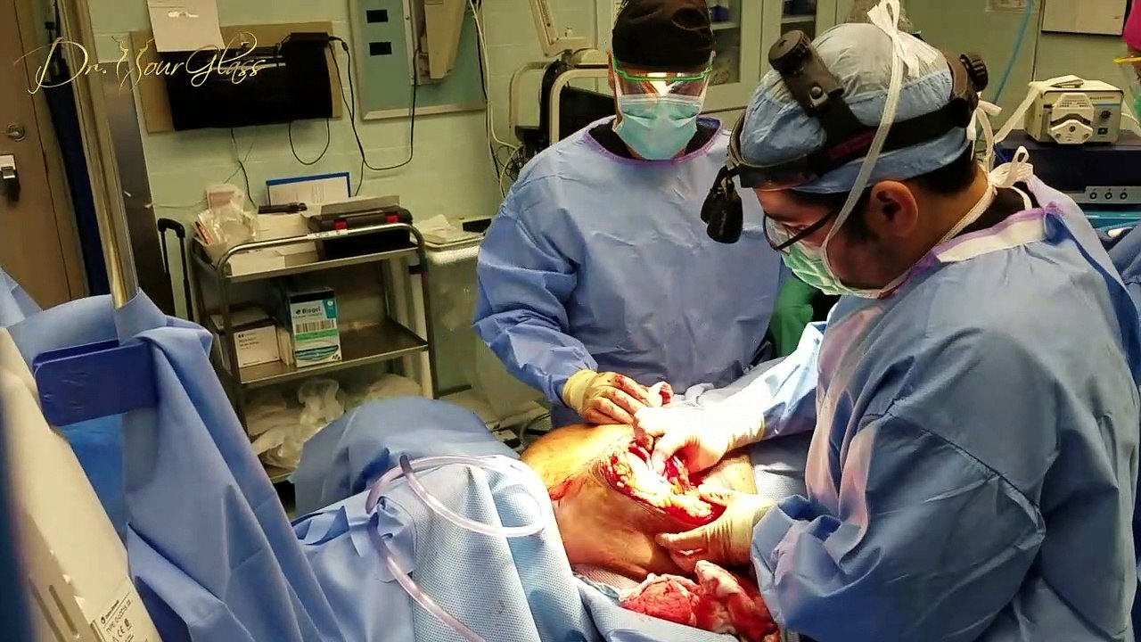 Post Operative Consultation After Breduction