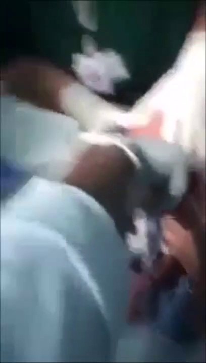 Ce bébé sauvé de justesse par des docteurs alors qu'il avait avalé un morceau de collier en métal