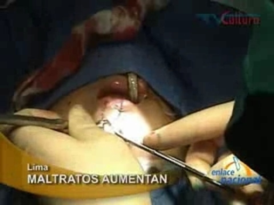MALTRATOS AUMENTAN - LIMA