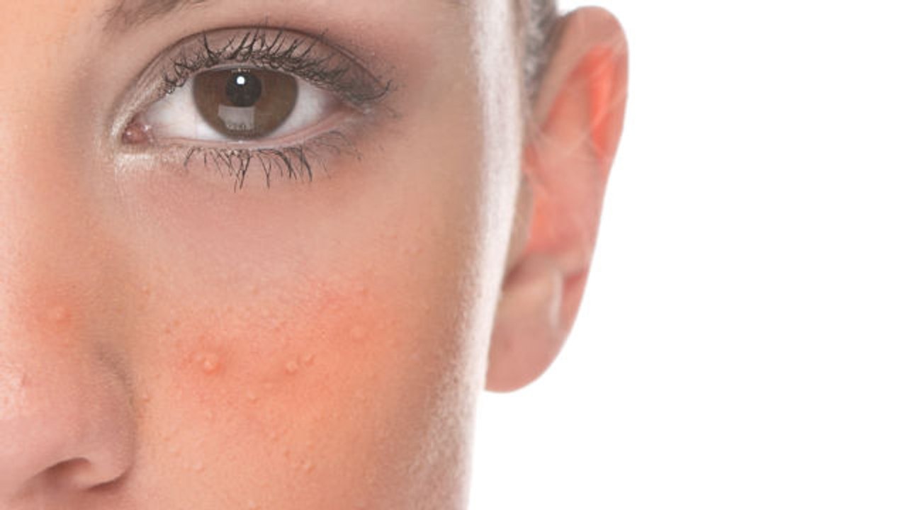8 Reasons Your Face is Red