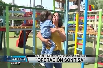 Operación Sonrisa: niños con labio leporino serán operados gratuitamente