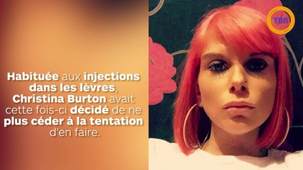 En appliquant une crème sur sa bouche, ses lèvres ont gonflé et se sont transformées en saucisses !