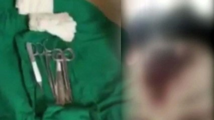 주름 제거 시술 받았는데 이마 '괴사'...무슨 일이? / YTN