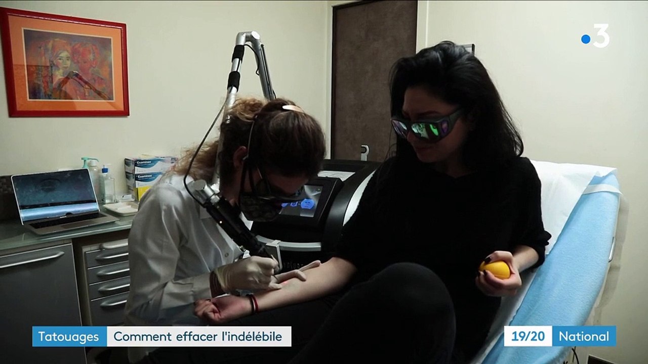 Tatouages : effacer l'indélébile