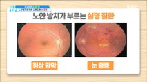 [HEALTH] If you neglect your presbyopia, will your eyes have a paralysis?,기분 좋은 날20190430