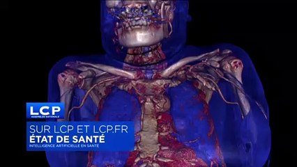 ETAT DE SANTE - Bande Annonce - Intelligence artificielle en santé, comment rester dans la course ?