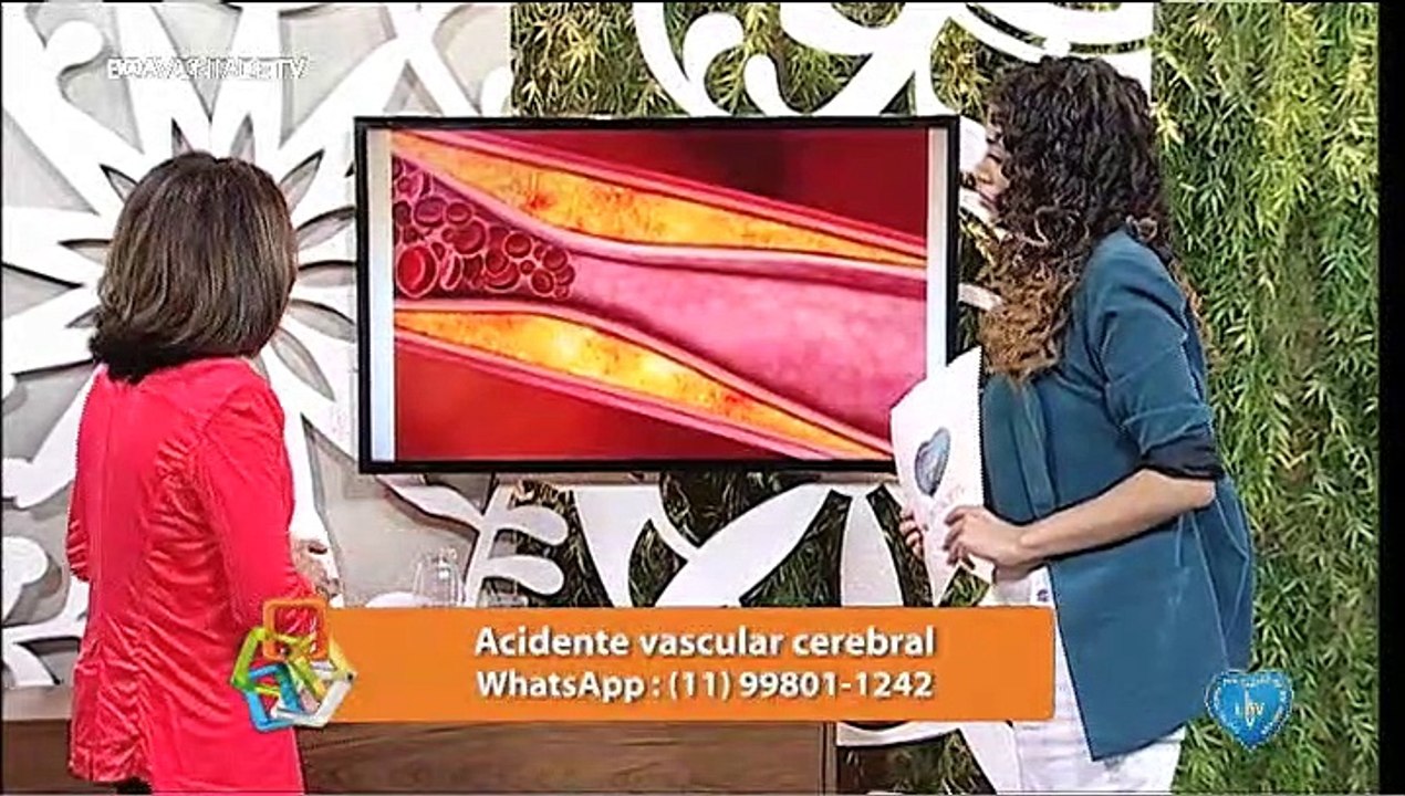 Acidente Vascular Cerebral
