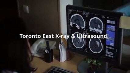 Baby Ultrasound Toronto