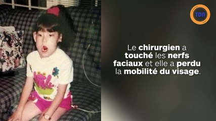 Victime d’une erreur médicale, elle ne peut plus fermer les yeux et la bouche !
