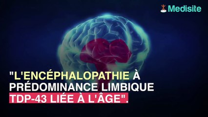 Maladie d'Alzheimer : des millions d'erreurs de diagnostic