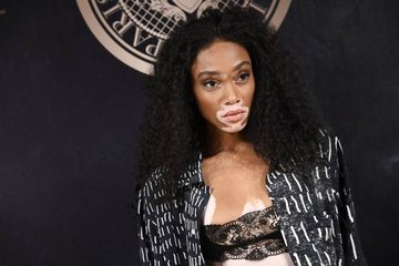 Ihre Krankheit ist ihre Stärke: Porträt von Winnie Harlow.