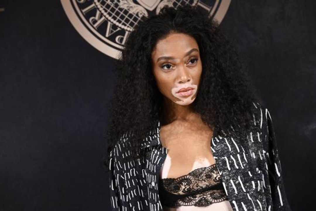 Ihre Krankheit ist ihre Stärke: Porträt von Winnie Harlow.