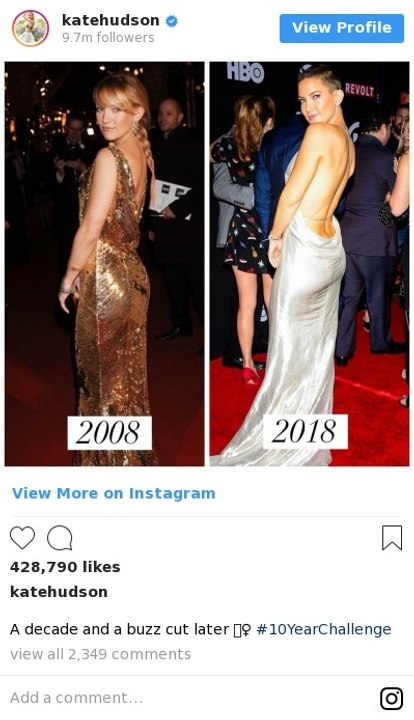 #10yearschallenge: diese Stars 10 Jahre später