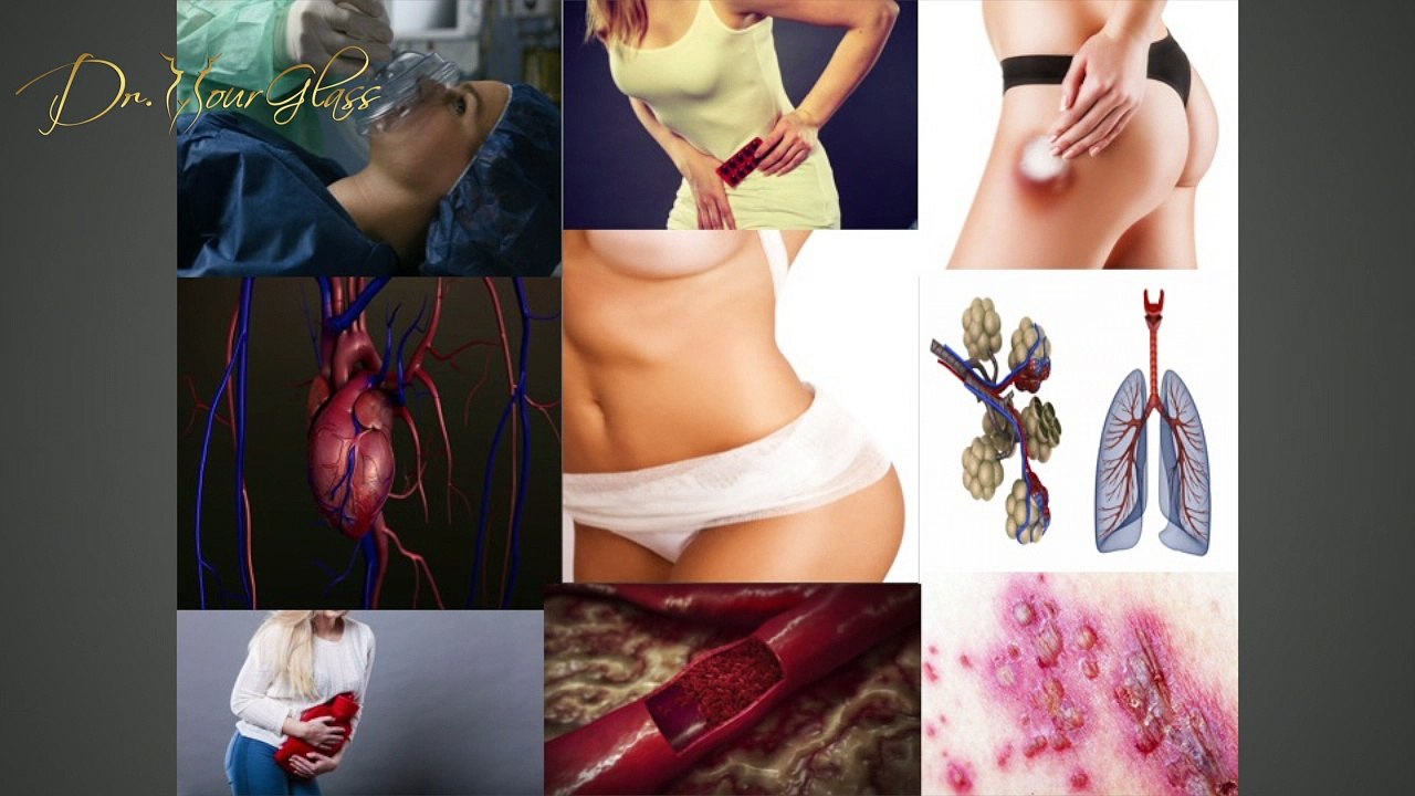 3 things to do before your tummy tuck surgery
