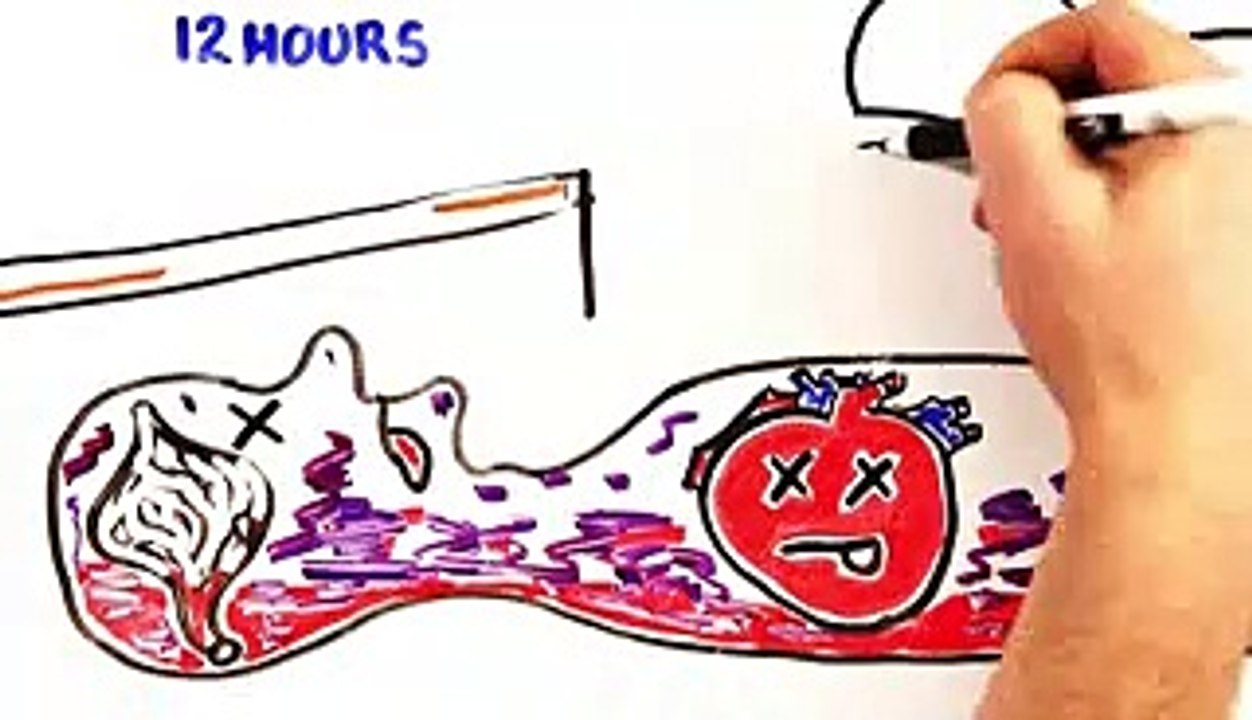 human body after death
