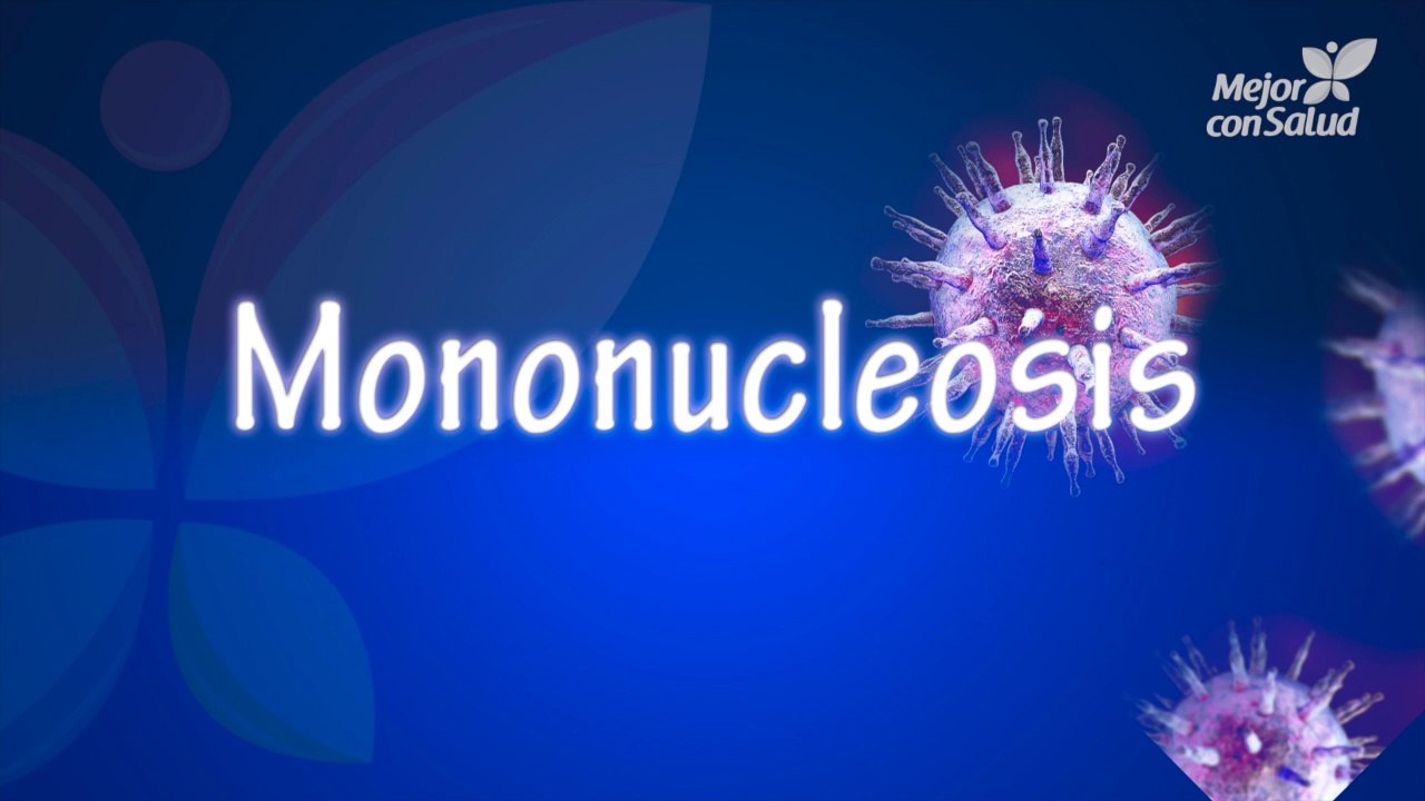 Mononucleosis: síntomas y tratamientos