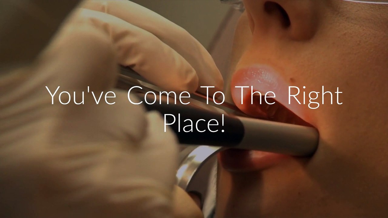 Select Dental Care : Root Canal in Coral Springs, FL