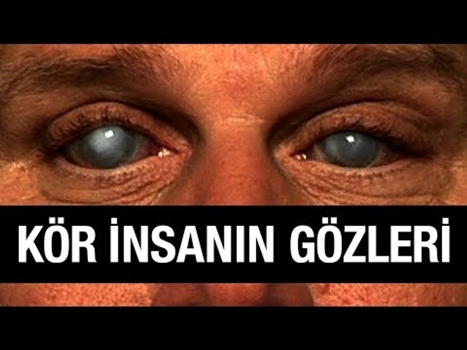 Körler Gözünü Açabilir mi?