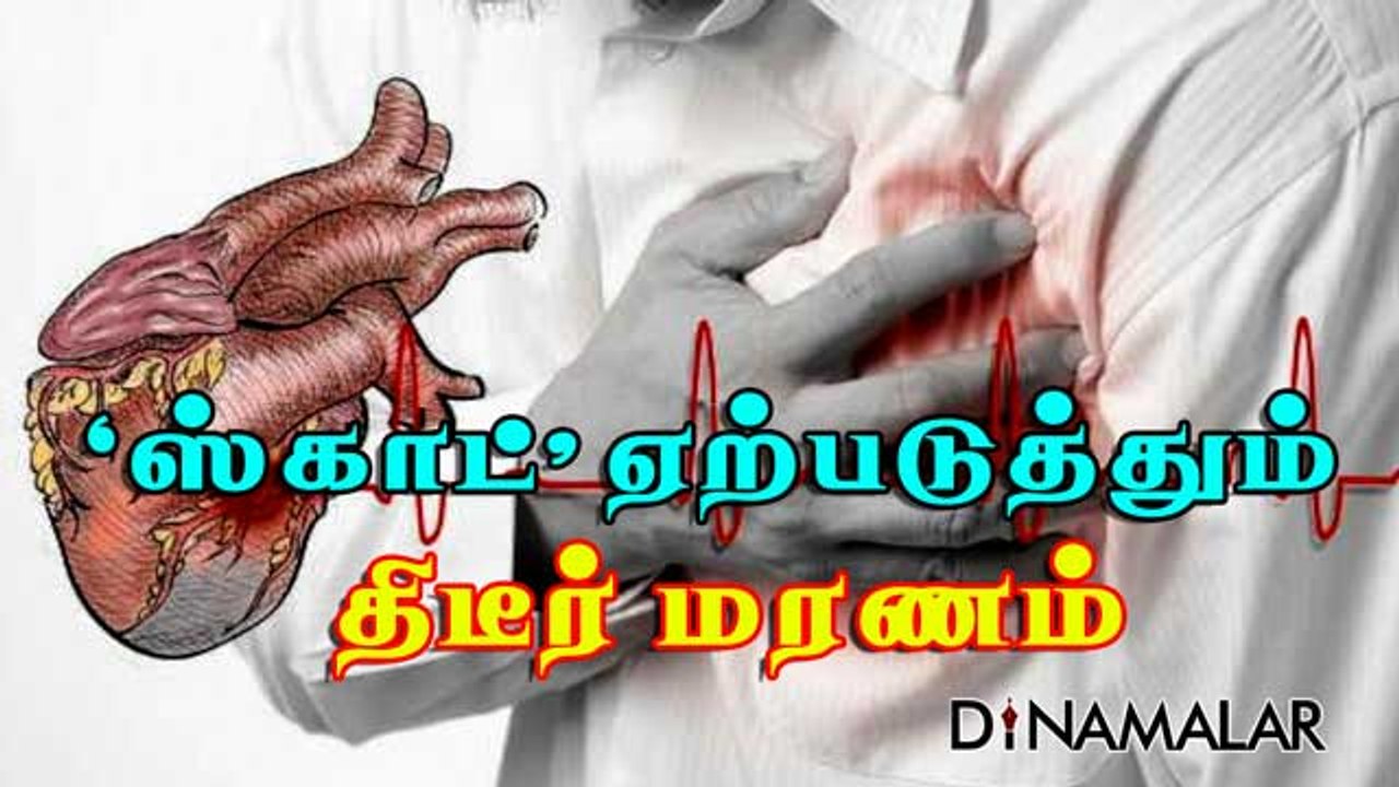 ’ஸ்காட்’ ஏற்படுத்தும்  திடீர் மரணம்