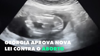 A polêmica lei contra o aborto