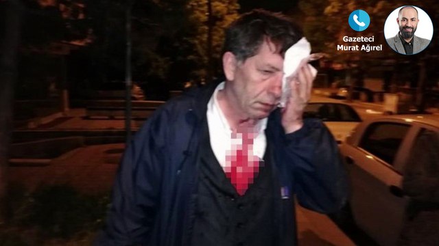Gazeteci Ağırel: Yeniçağ yazarına yapılan saldırı Çubuk’taki cezasızlığın devamı, seçim öncesi bu saldırılar sürebilir
