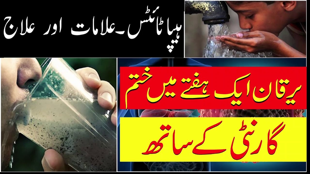 Hepatitis A B C Types, Symptoms in Urdu || ہیپاٹائٹس کی علامت اور علاج
