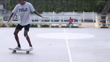 Un joven tanzano con vitíligo alcanza su sueño de convertirse en modelo