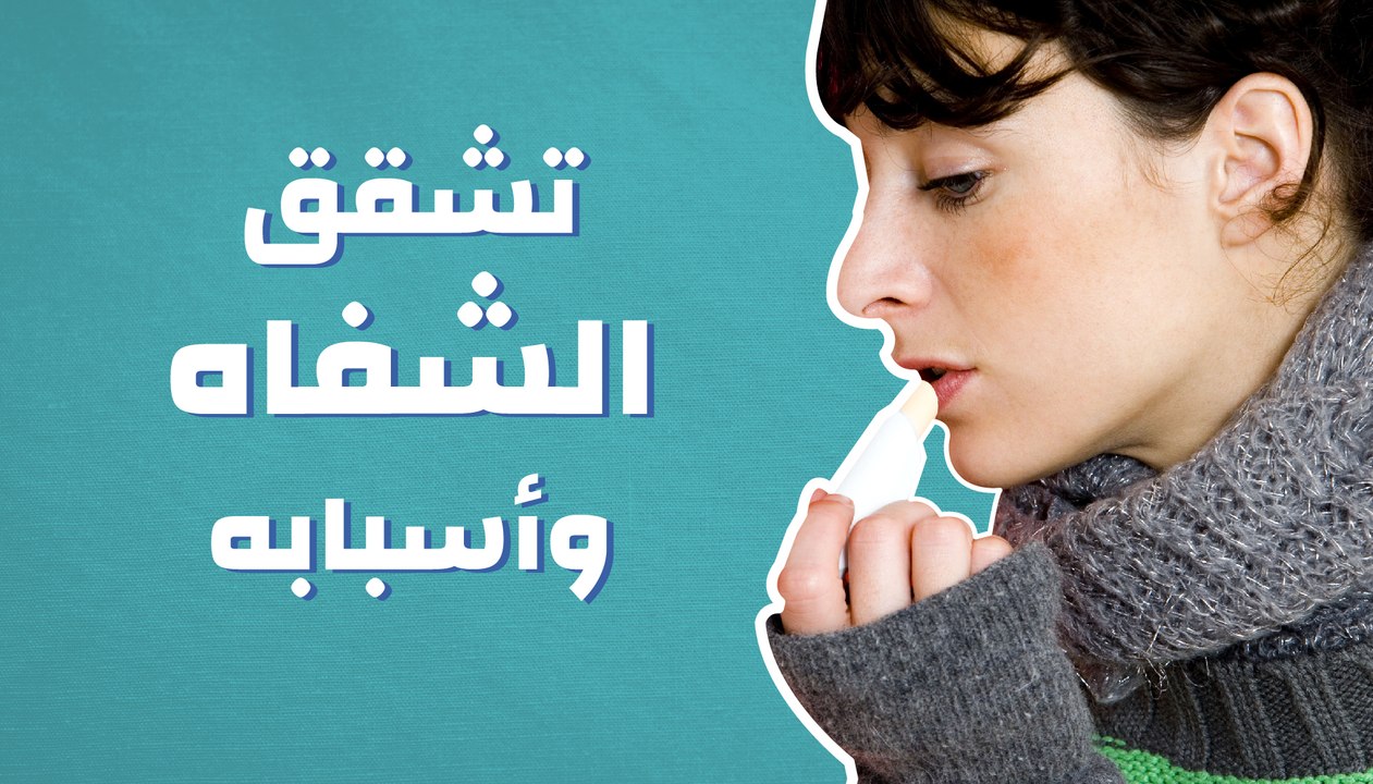 تشقق الشفاه وأسبابه