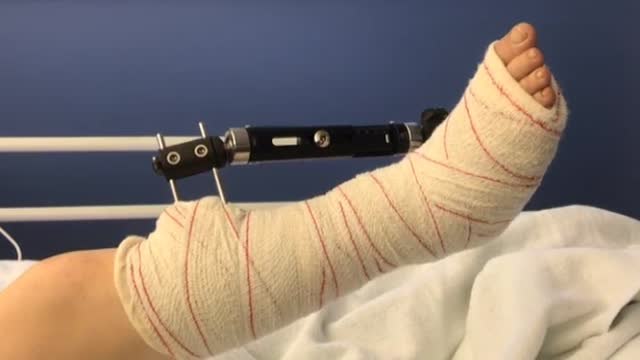 Las víctimas de violencia de género tardan de media casi nueve años en denunciar