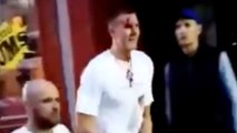 Kristaps Porzingis Gets JUMPED & Left Bloody In Gang Fight Revealing He MAY Have A Broken Hand