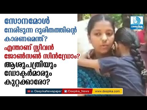 കണ്ണു നനയിച്ച് സോനമോളുടെ മുഖം, ഈ ദുരിതത്തിനു കാരണമെന്ത്? Sonamol Face Turns a Wound for Malayalees
