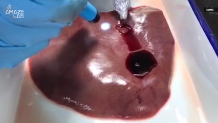 This New Superglue Can Heal Fatal Wounds in Just Seconds!