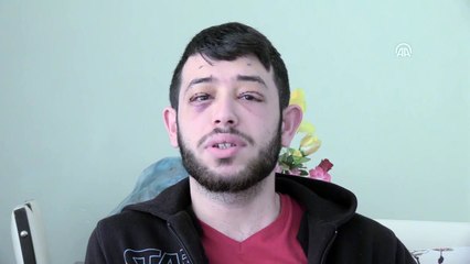 Göz kapağı sorunu iş bulmasına engel olunca ameliyat masasına yattı - SAMSUN