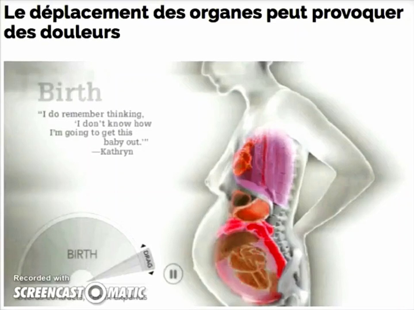Déplacement des organes lors de la grossesse (Animation) - Vidéo Dailymotion