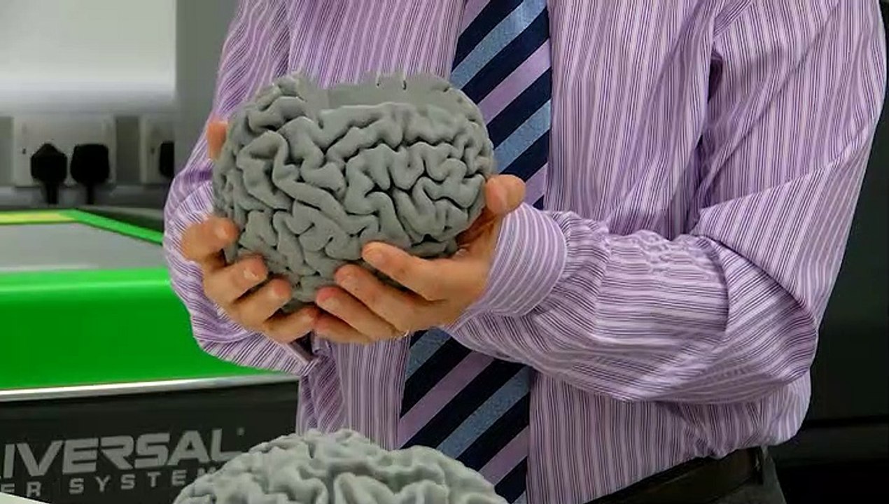 3D Printed Brains At UWE!