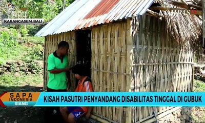 Kisah Pasutri Penyandang Disabilitas Tinggal di Gubuk