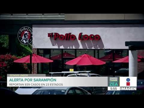 Suman más de 800 casos de sarampión en 23 estados de Estados Unidos | Noticias con Francisco Zea