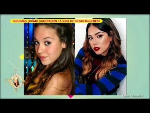 Cirugías, ¿cómo cambiaron la vida de estas famosas? | De Primera Mano